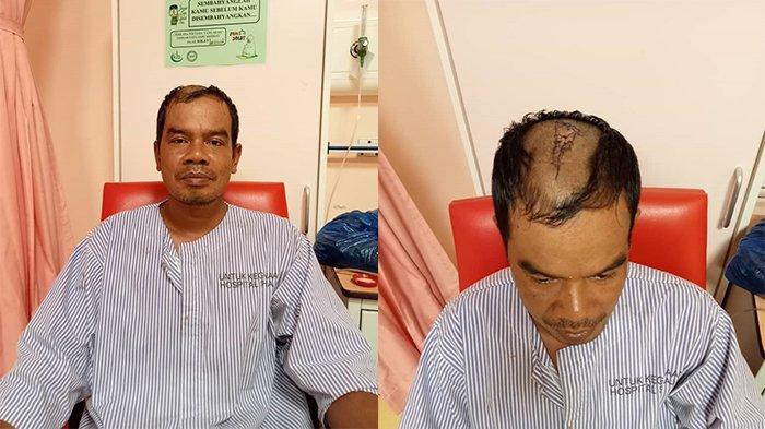 Alami Kecelakaan Kerja di Malaysia, TKI Asal Aceh Tamiang Ini Butuh Bantuan Agar Bisa Pulang Kampung