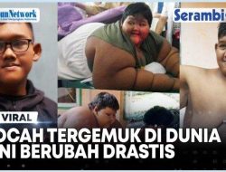 VIDEO – Arya Permana Bocah Tergemuk di Dunia, Kini Kondisinya Berubah Drastis